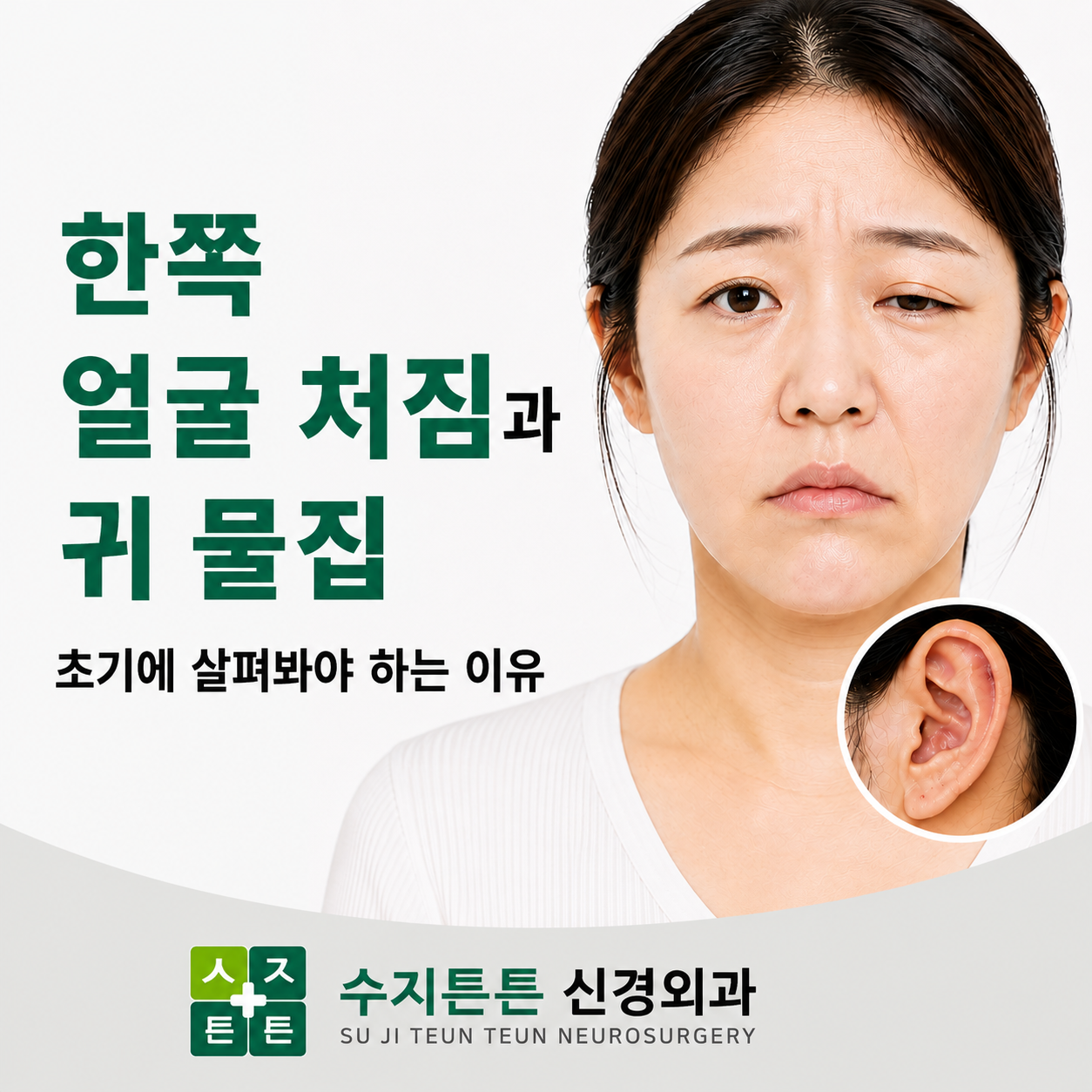 한쪽 얼굴 처짐과 귀 물집 - 초기에 살펴봐야 하는 이유
